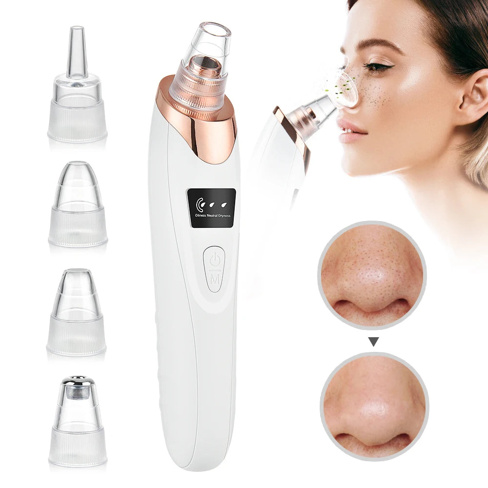 5-in-1 Electric Blackhead Remover Vacuum | Deep Pore Acne & Oil Suction Face Cleaner