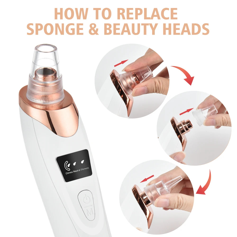 5-in-1 Electric Blackhead Remover Vacuum | Deep Pore Acne & Oil Suction Face Cleaner